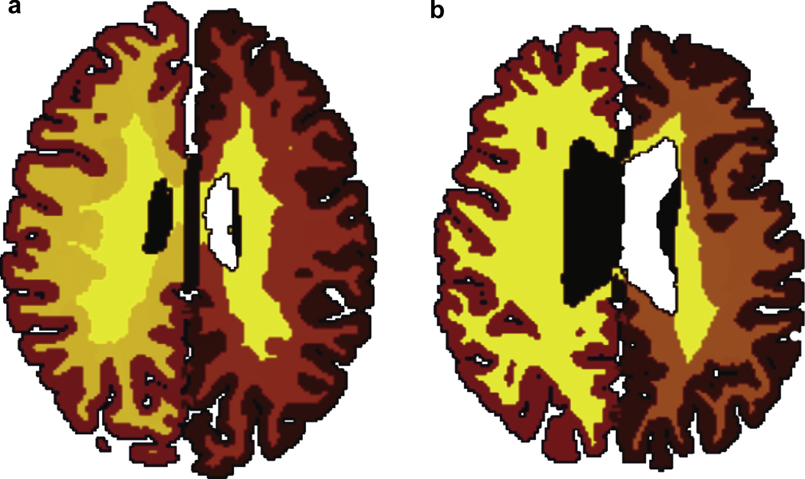 by-middle-age-obesity-ages-your-brain-an-additional-10-years-big-think