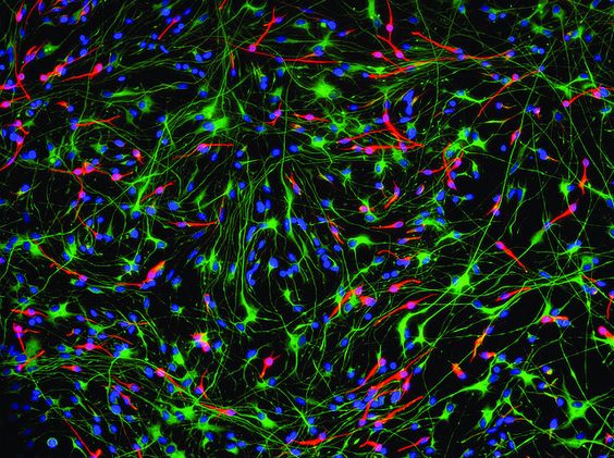 Human Brain Cells Don’t Continue To Grow Into Adulthood, According To A ...