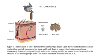 Your tattoo is leaking metal into your body's lymph nodes: study