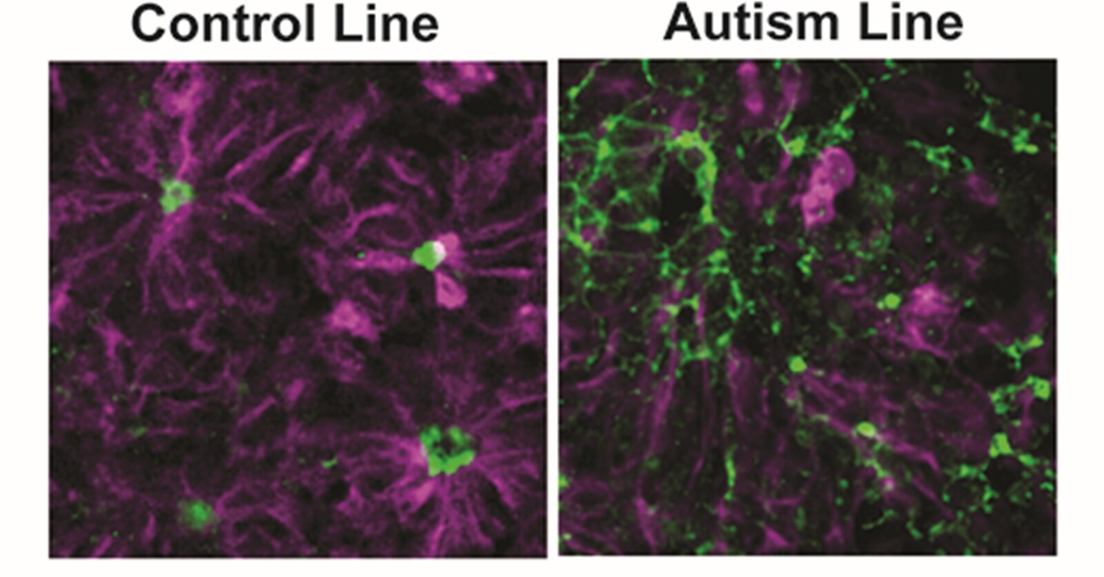 study-autistic-brains-develop-differently-before-birth-big-think