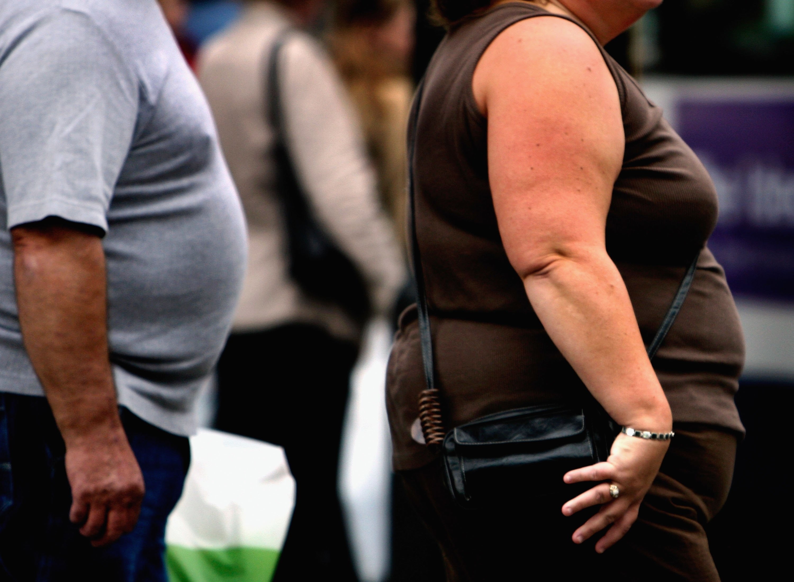 New Guidelines Redefine Obesity To Curb Fat Shaming Big Think