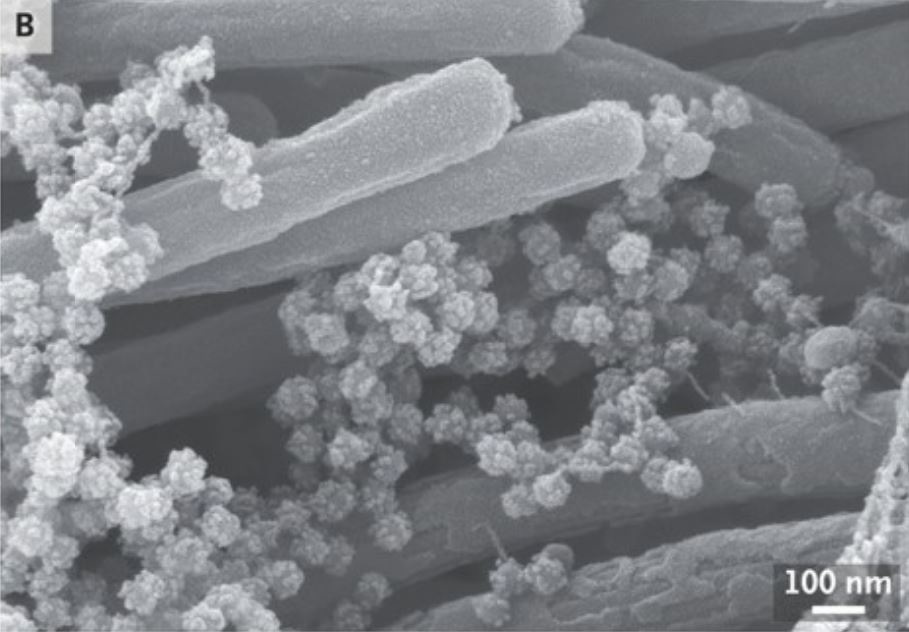 Coronavirus aggressively invades lung cells in chilling new images ...