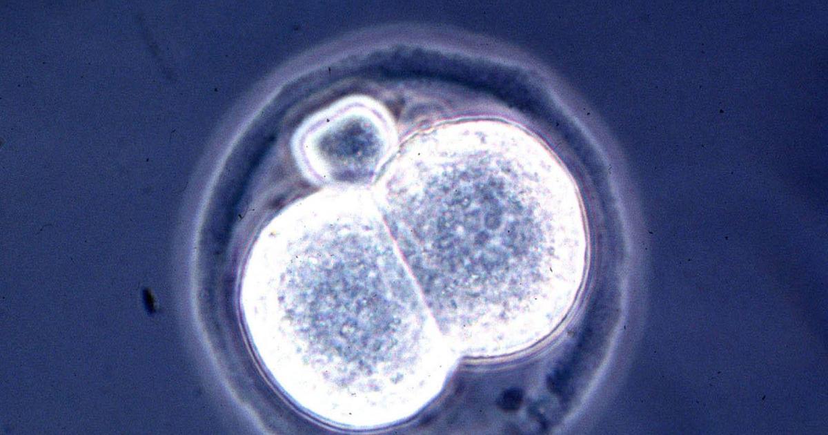 Are Lab grown Embryos And Human Hybrids Ethical Big Think