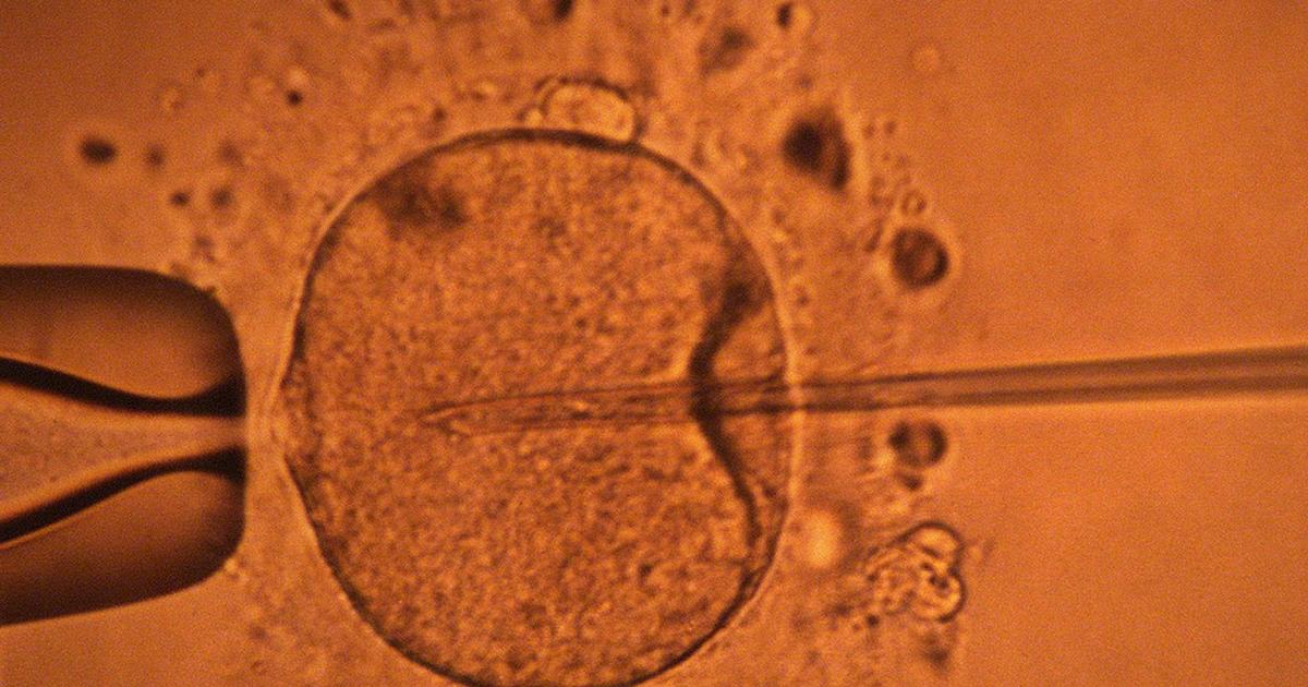 Sperm may play bigger role in pregnancy than we thought - Big Think