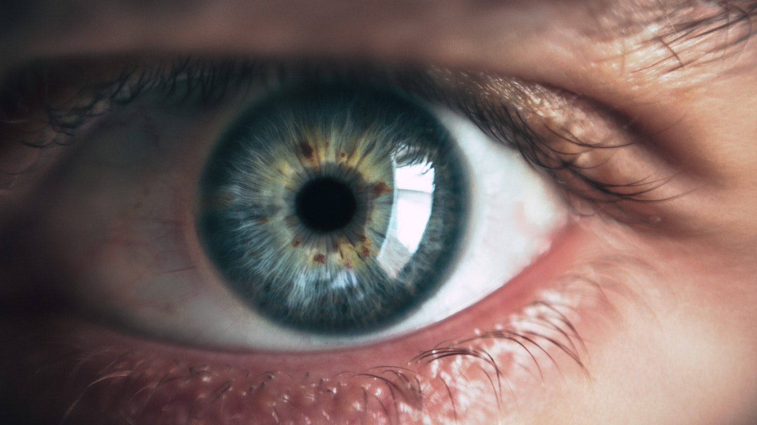 prozac blindness