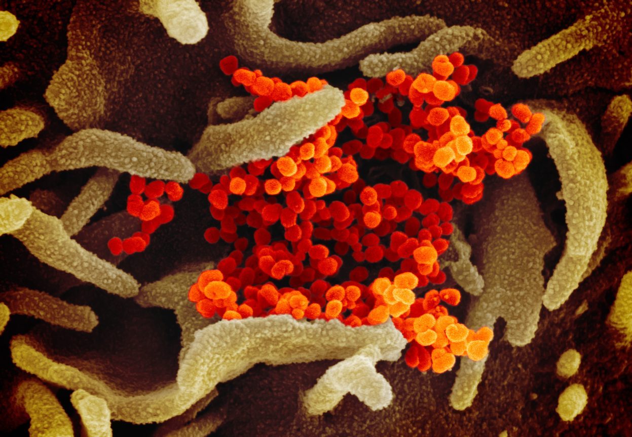 Las enfermedades respiratorias, como estas nuevas partículas de coronavirus, pueden ser una causa de SMSL.