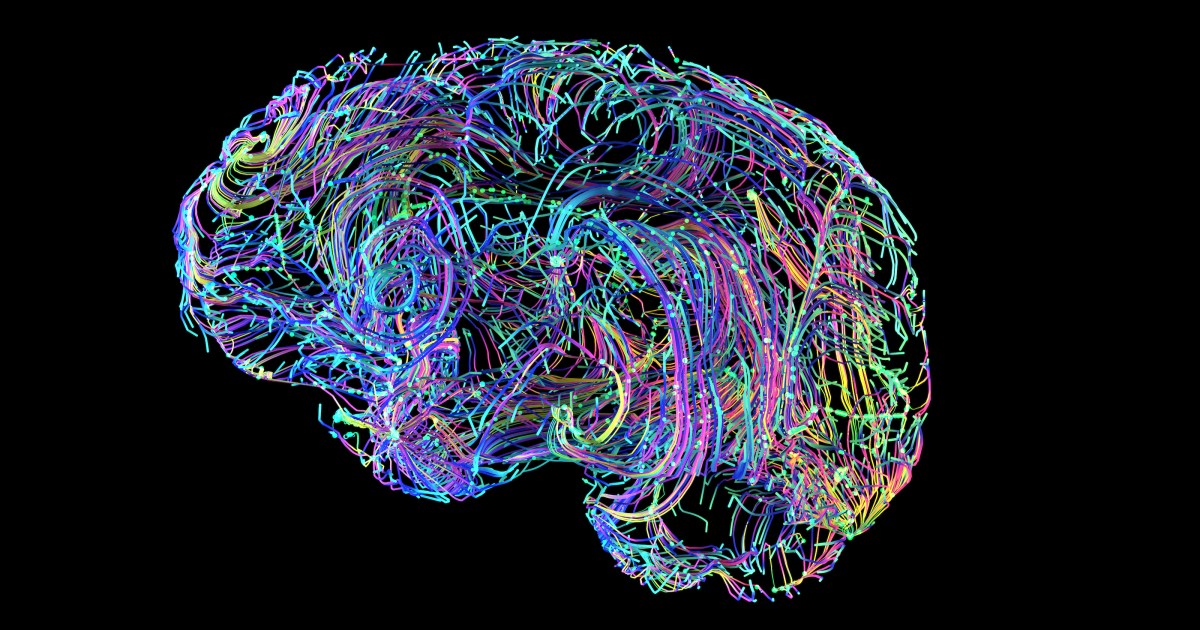 The brain undergoes a great "rewiring" after age 40