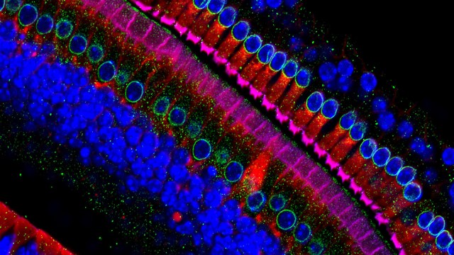 a colorful image of hair cells under a microscope