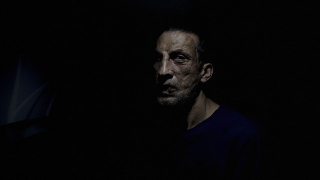 A man undergoing a face transplant glare at the camera in a dimly lit room.