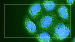 An image of a green cell with blue dots on it.
