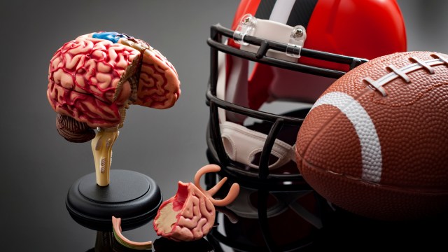A model of a brain and a football on a black surface, highlighting the connection between sports and CTE.