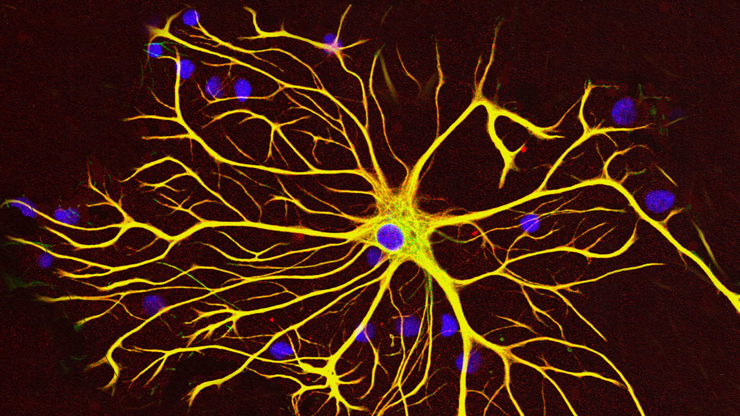 An image of a new neuron with blue and yellow lights.