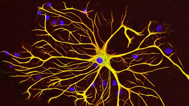 An image of a new neuron with blue and yellow lights.