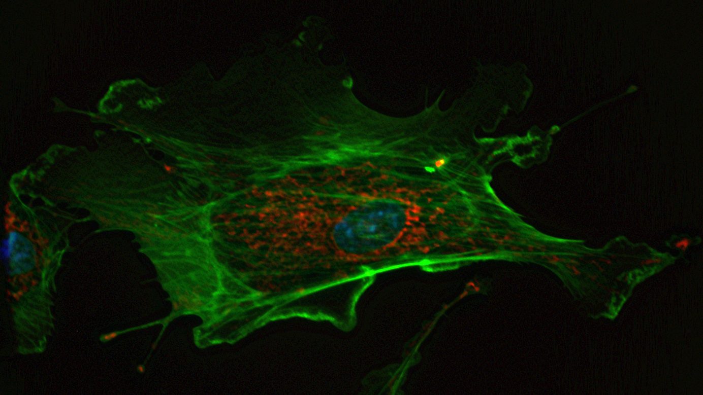 An image of a green cell with prominent organelles in a dark room.