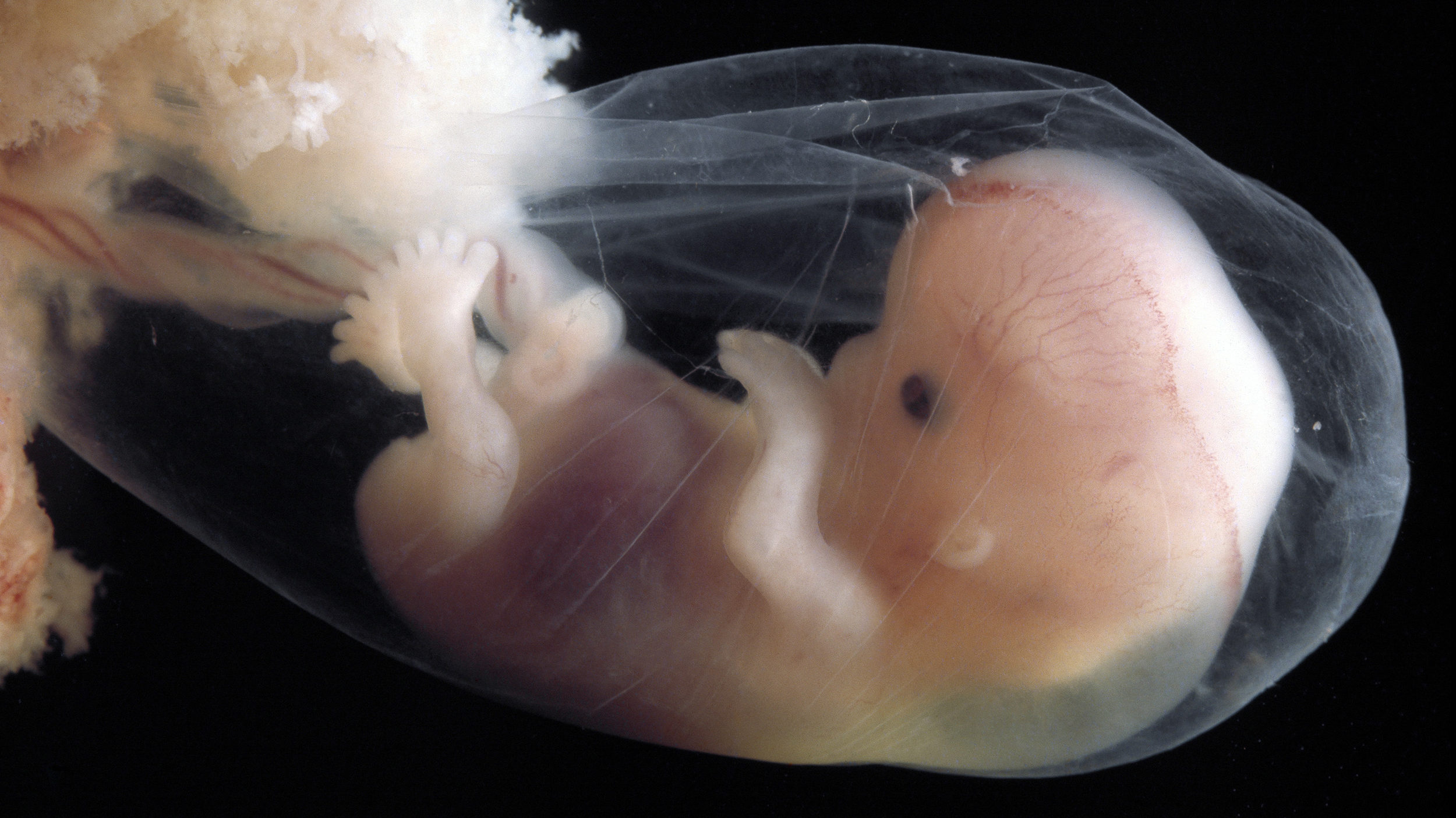 An image of a fetus in an incubator.