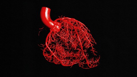 A lepodisiran image of a human heart on a black background.