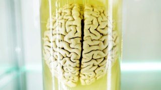 A human brain preserved in a clear glass container filled with a yellowish preserving fluid, set against a bright, light green background.