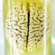 A human brain preserved in a clear glass container filled with a yellowish preserving fluid, set against a bright, light green background.