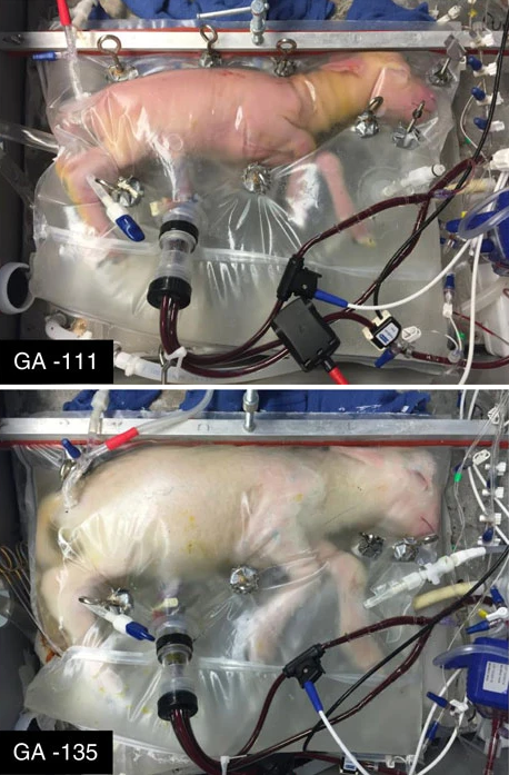 Two images of developing lambs in transparent, fluid-filled artificial wombs labeled "GA -111" and "GA -135". Both lambs are connected to tubes and medical equipment.