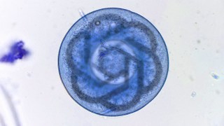 Microscopic view of a translucent, spiral-shaped Trichinella spiralis larva within a blue-stained muscle tissue.