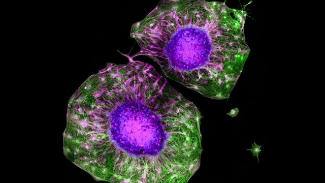 Two colorful cells with purple nuclei, green cell edges, and radiating filament structures against a black background.