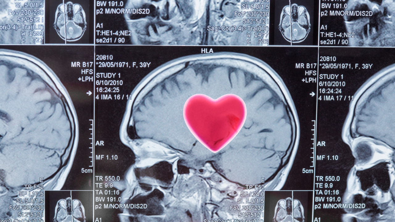 MRI brain scan images with a large red heart shape digitally added to the center of the brain on the main scan in the middle.