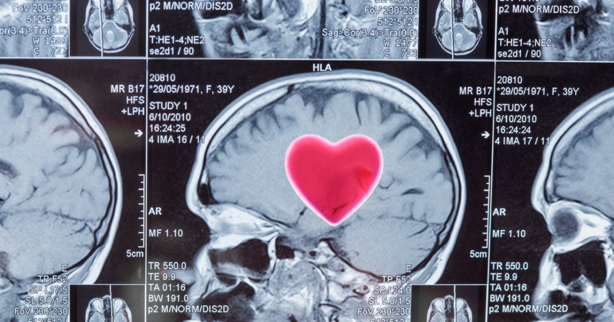 The chemical reason love makes you irrational
